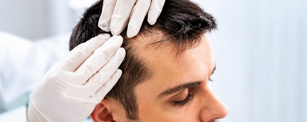 Best Dermatologist For Hair Problems Vile Parle