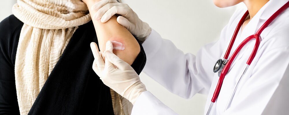 Best Dermatologist For Psoriasis Vile Parle