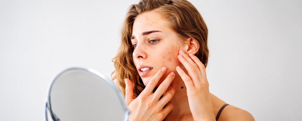 Best Dermatologist For Skin Pigmentation Vile Parle