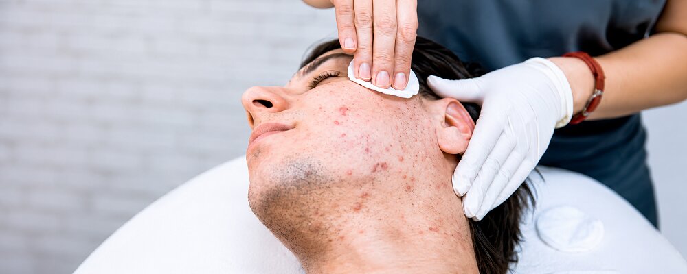 Best Acne Treatment Dermatologist in Vile Parle